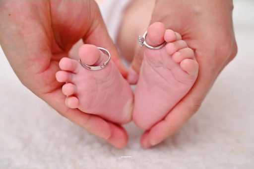 三亚宝宝长湿疹了怎么处理 三亚宝宝长湿疹了怎么处理